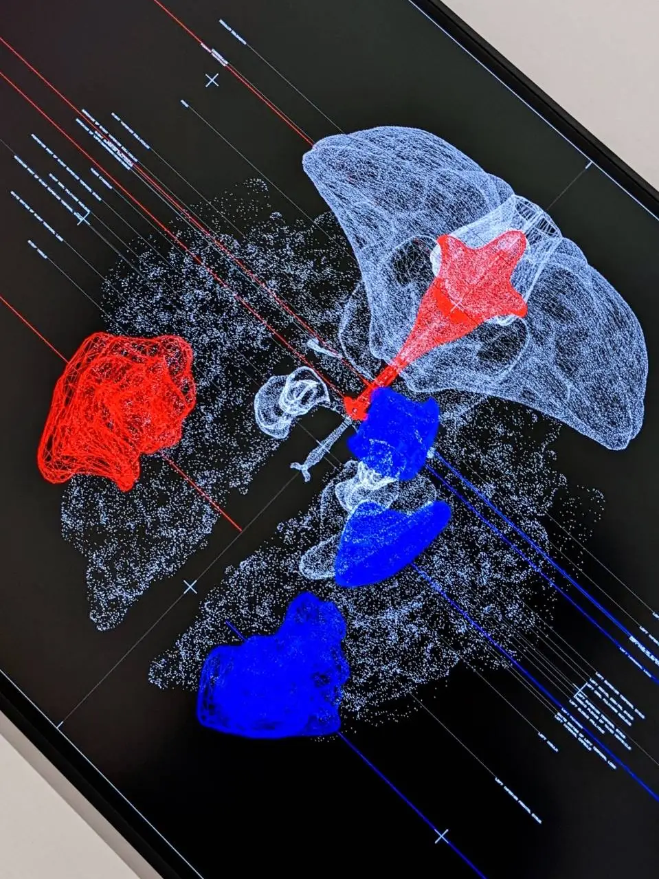 地球とひまわりのアクリル画 kazuya 新しく 