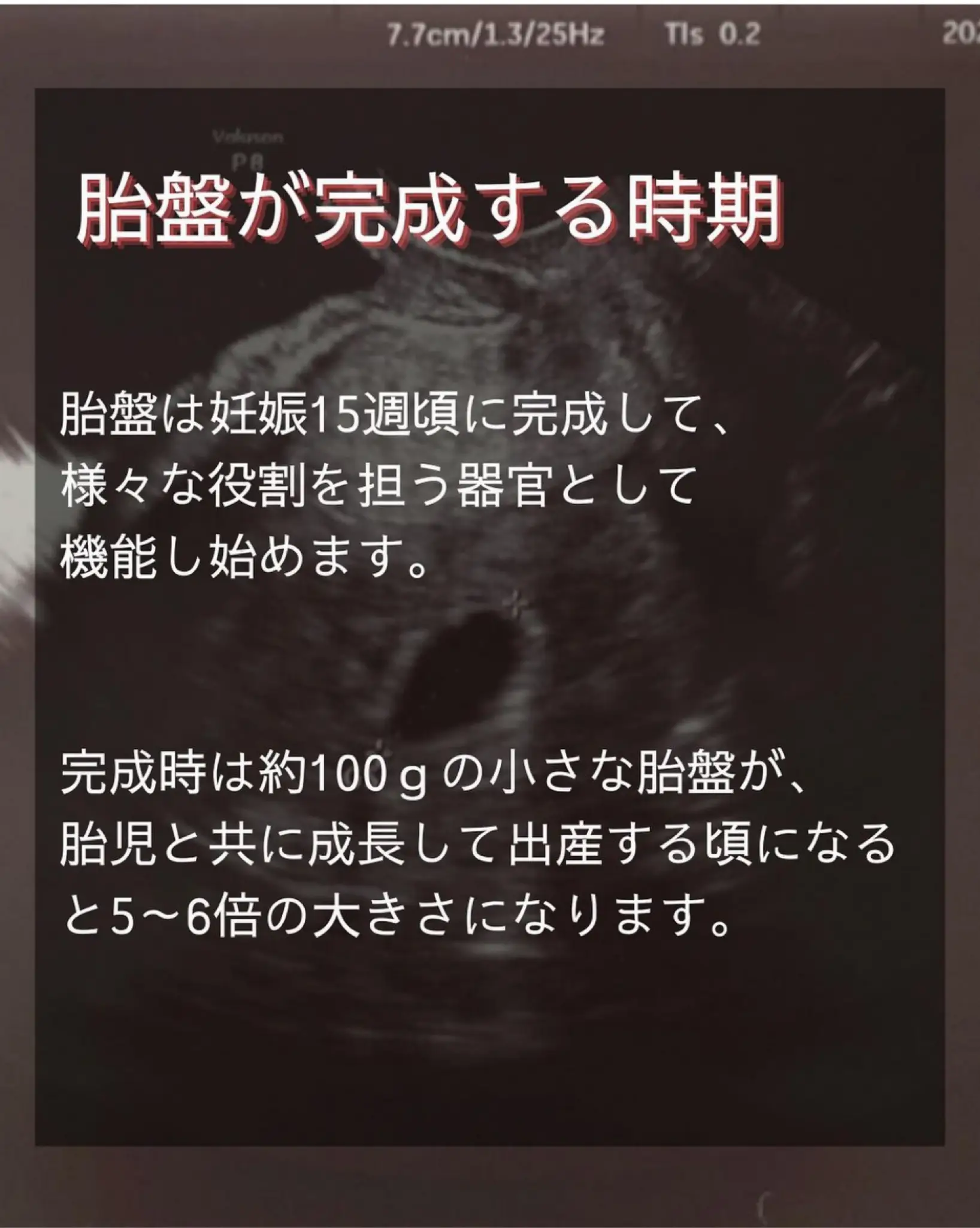 今さら聞けない？】胎盤とは？ | ゆーすけ_新米パパが投稿したフォト