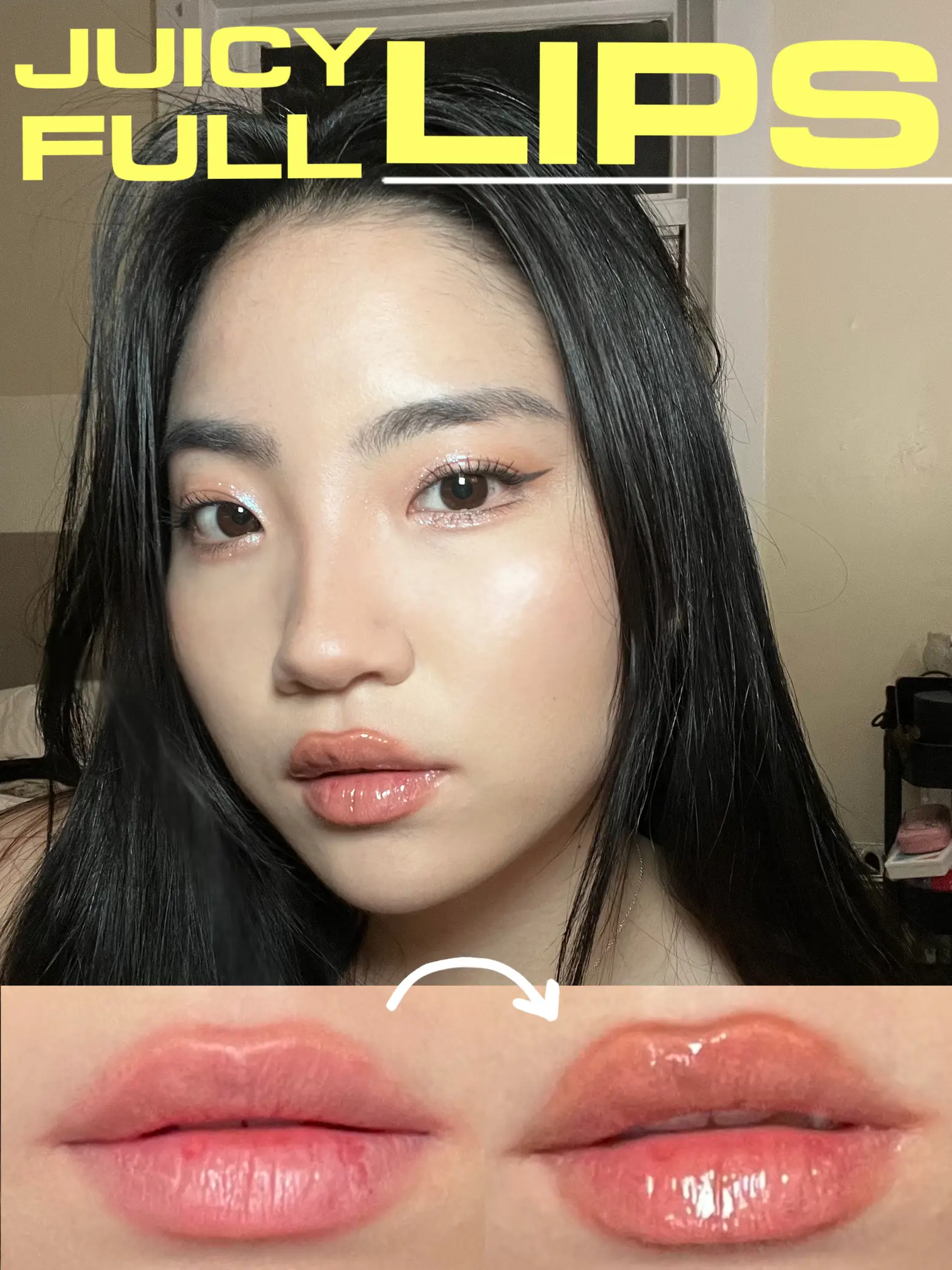 Non-Surgical Lip Filler | Gallery posted by Kayla Yoo | Lemon8