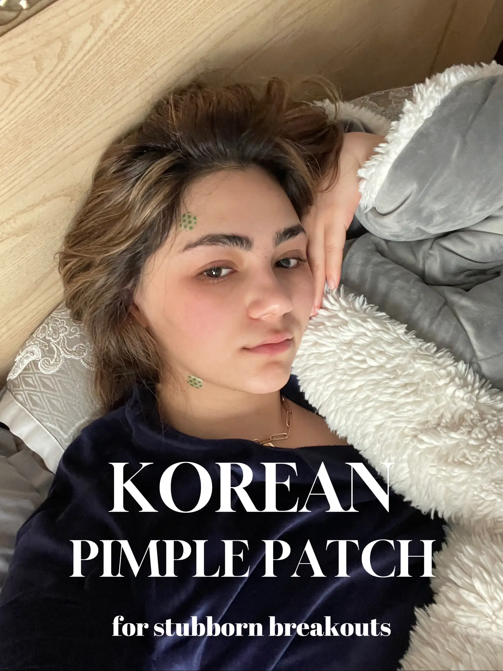 Korean Pimple Patch for Stubborn Breakouts Gallery posted by