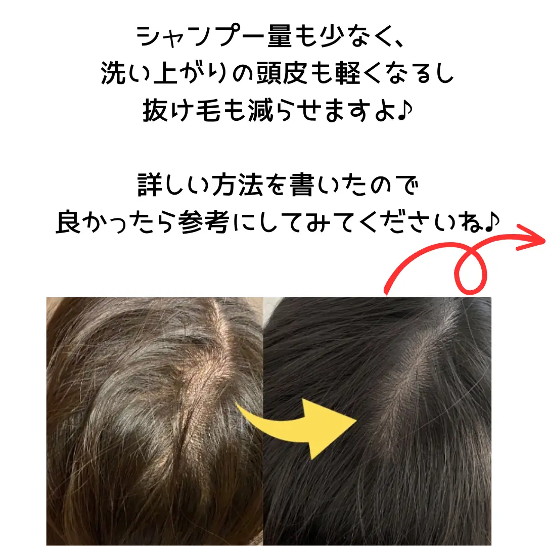 My hair is sticky and doesn't dry... Gallery posted by とも★シャワーヘッド詳しい
