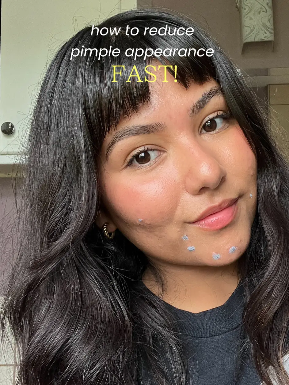 How To Get Glowy Skin with Acne-Prone Skin! ✨, Gallery posted by  jenafranco