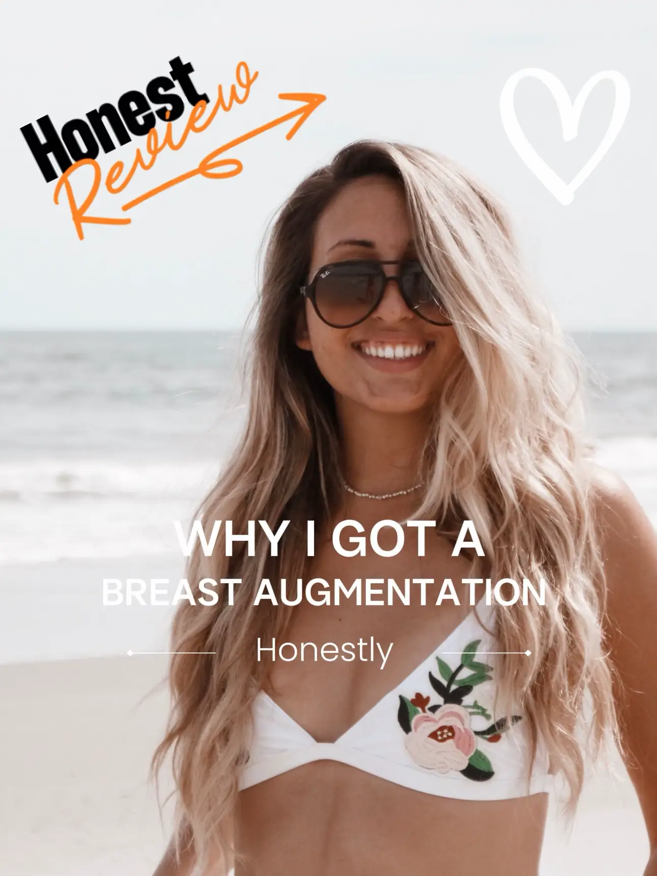 Why I got a Breast Augmentation at Age 24
