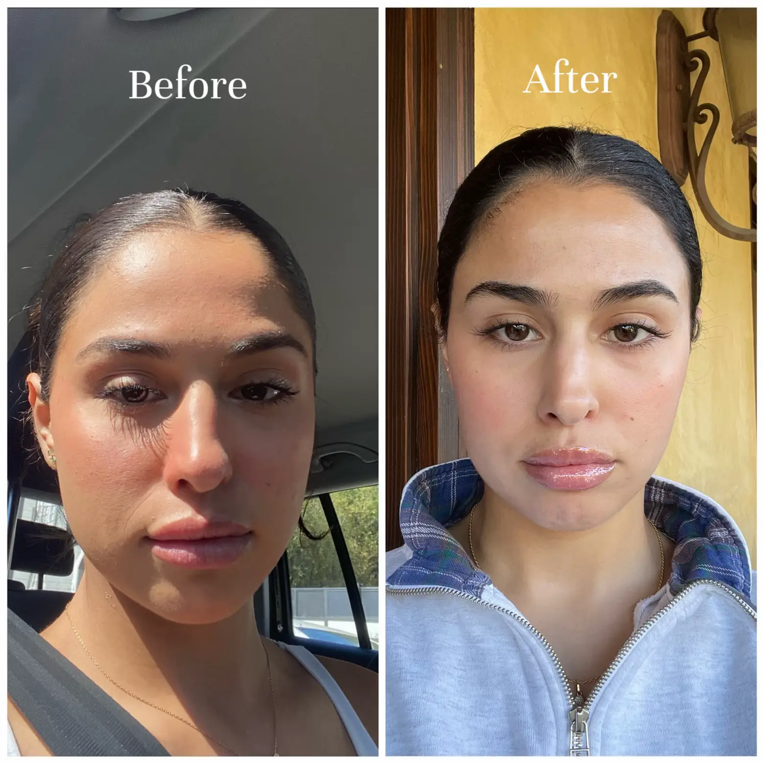 before and after sol beauty faja｜TikTok Search