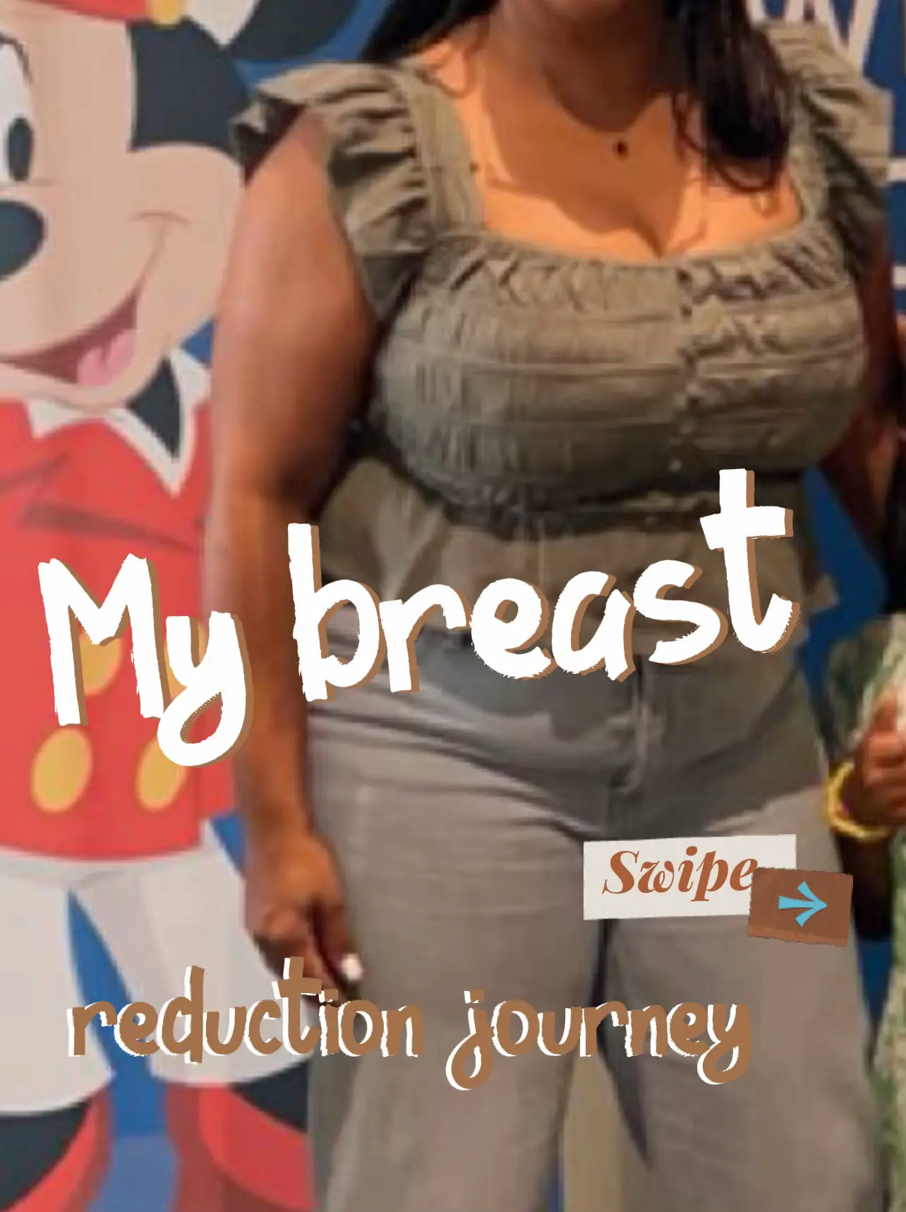 My size P boobs ruined my life - now I've dropped 21 cup sizes and can  finally breathe
