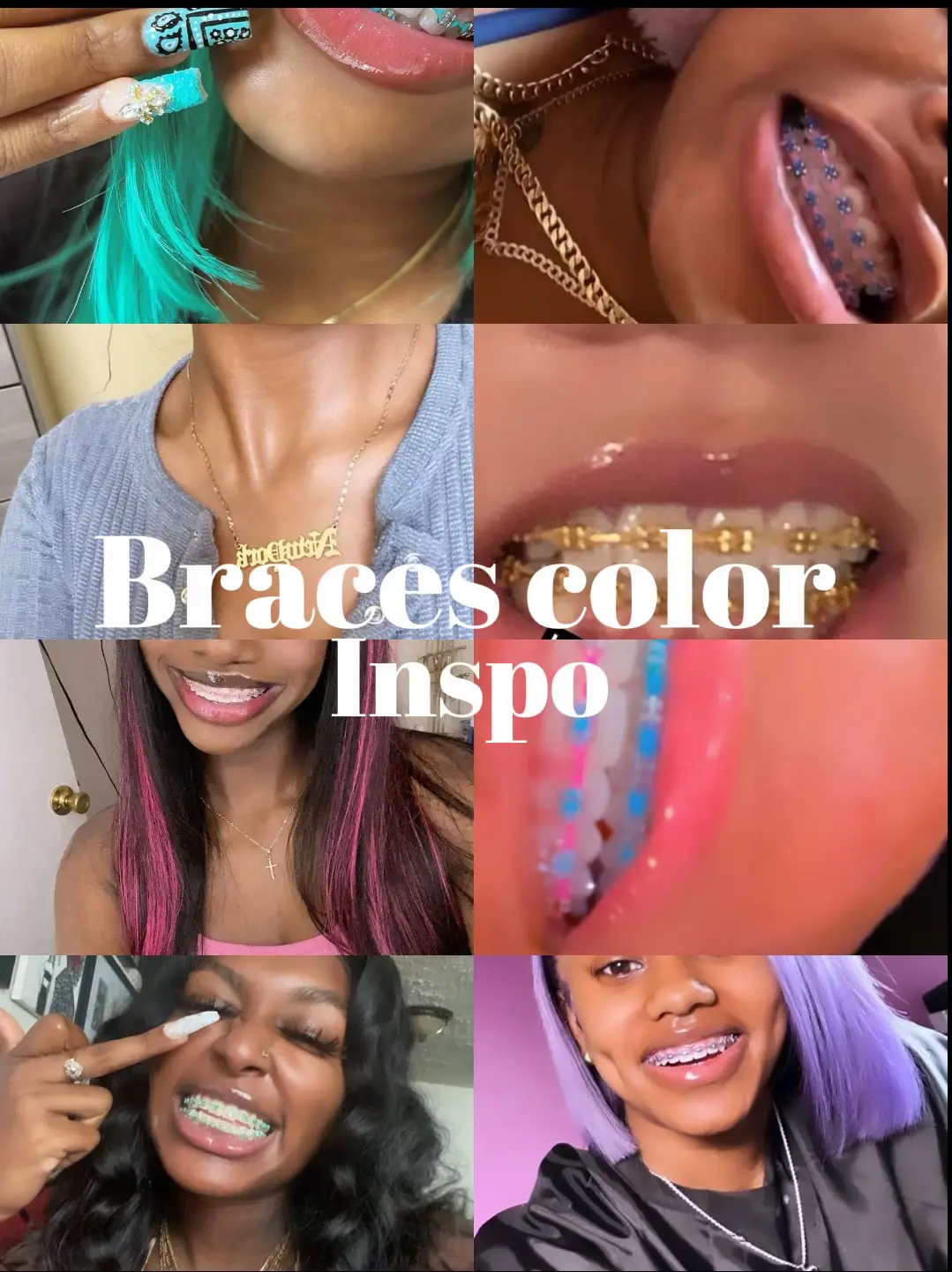 Braces Band Colors - Lemon8 Search