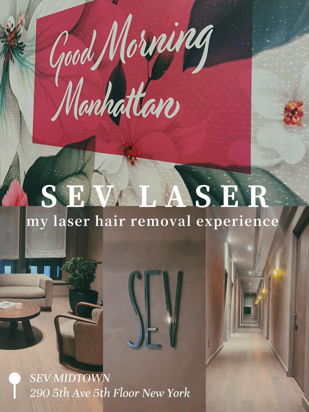 My laser hair removal experience Gallery posted by Sophia Romano