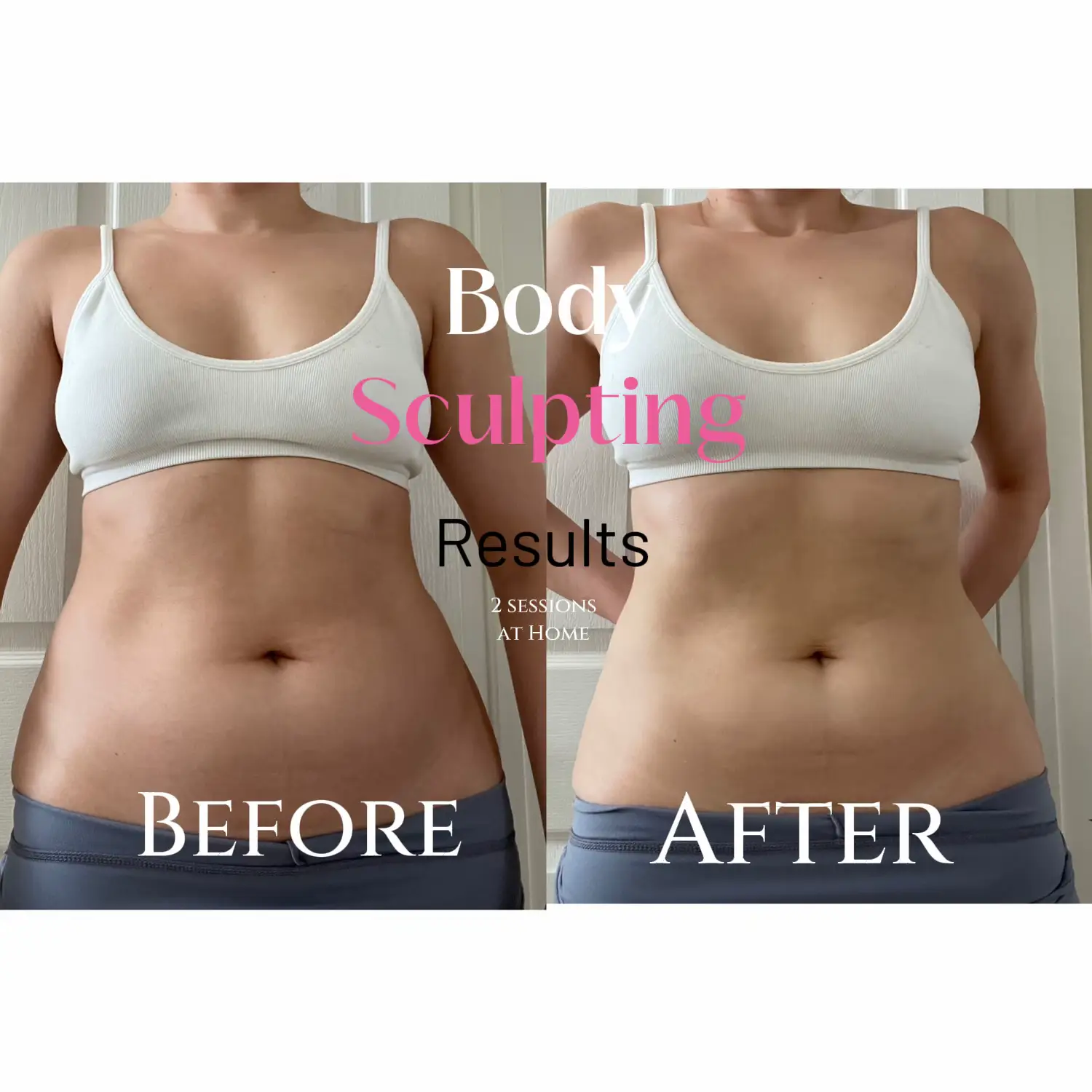 Body Sculpting Results, Gallery posted by SCULPTSKIN