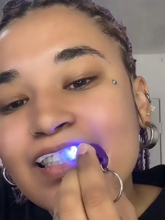 Gemzeez' Y2K Tooth Gems Are the Ultimate Beauty Accessory