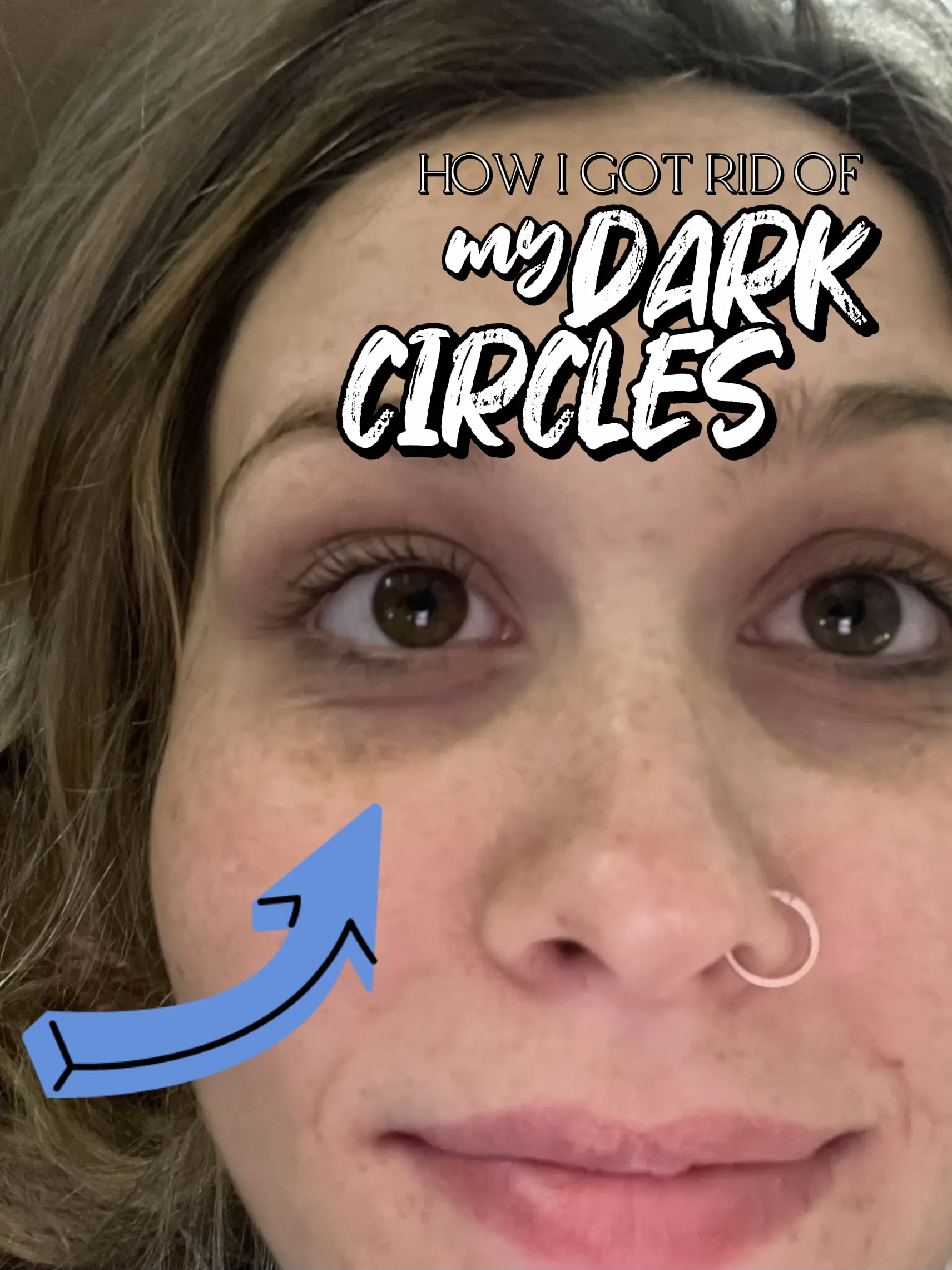 Castor Oil For Dark Circles  DIY Recipes For Under Eye Circles