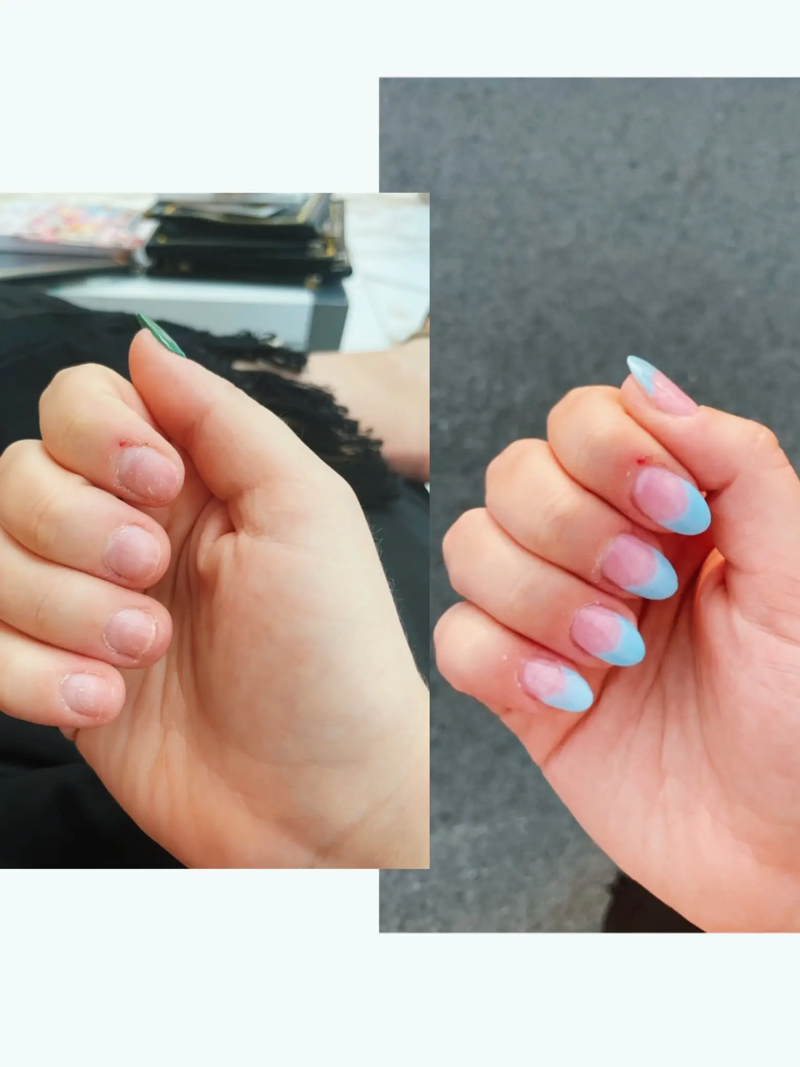 Acrylic vs. Gel Nails: Which One Is Right for You