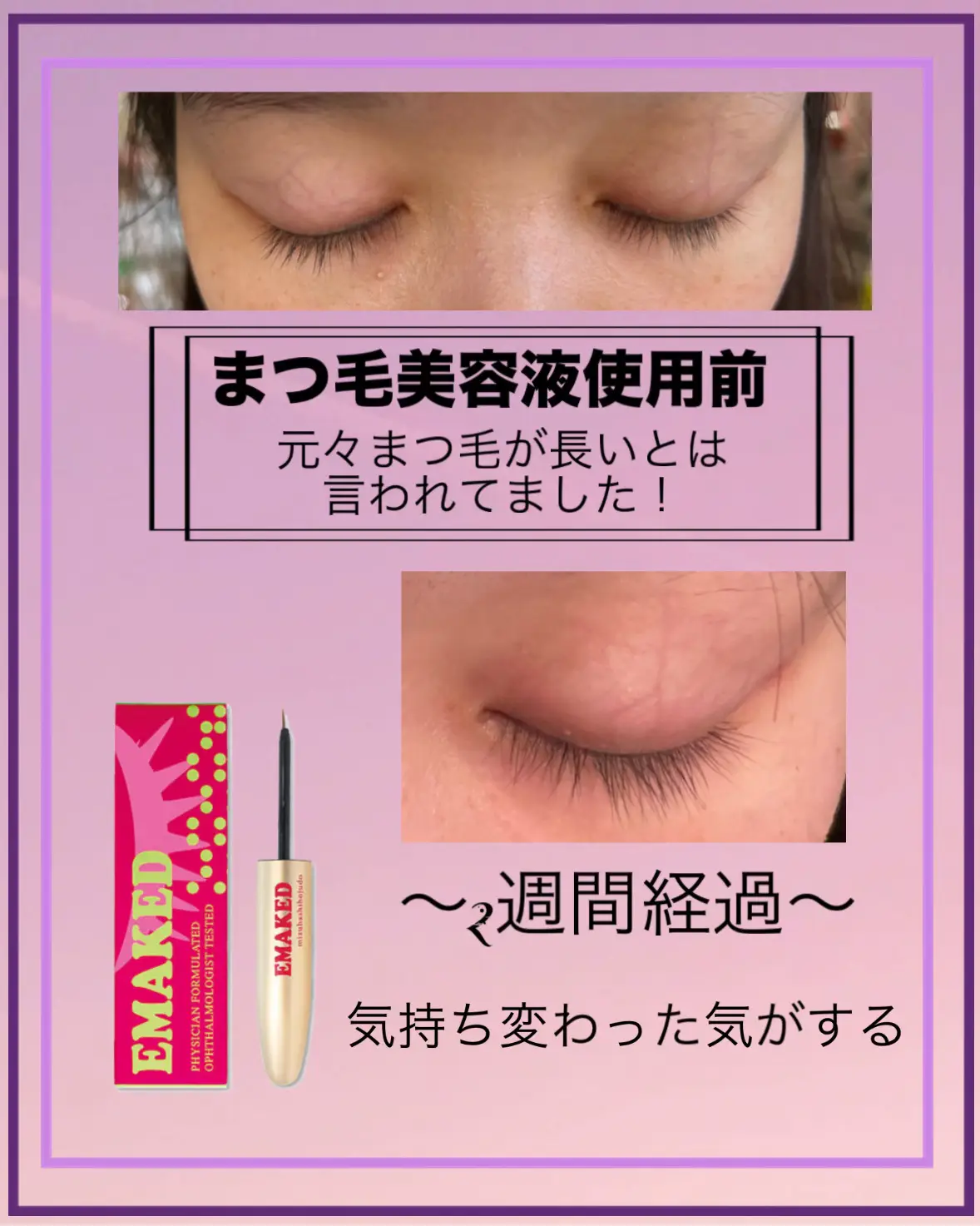 新品未開封】EMAKED まつ毛美容液& 5本セット