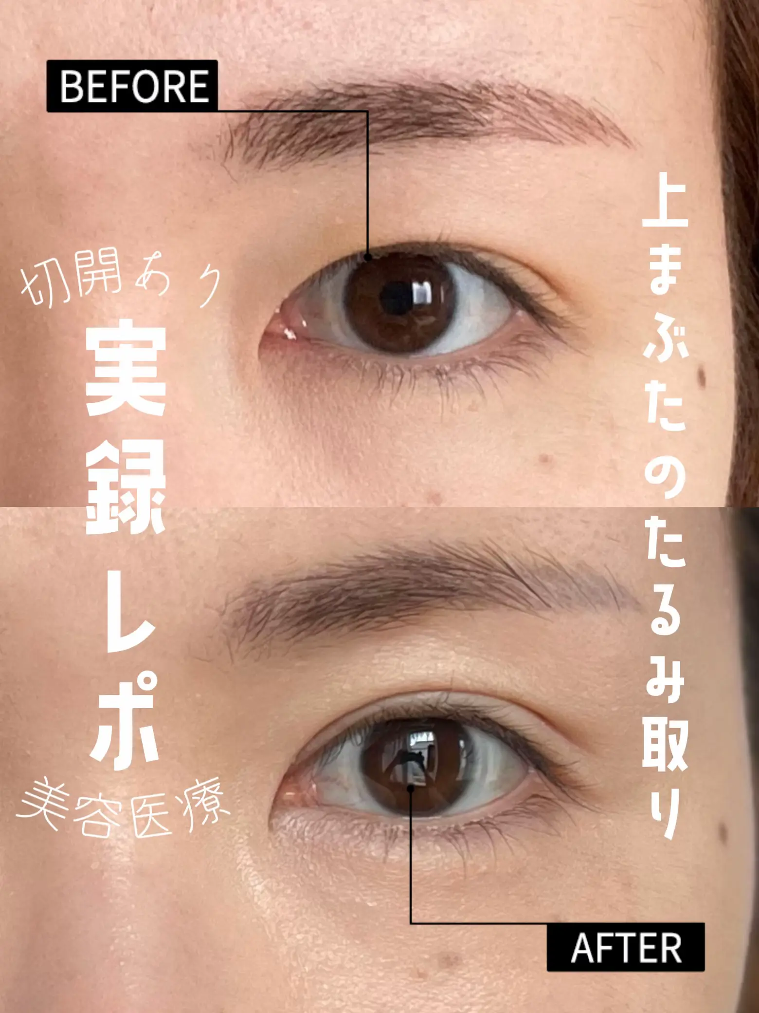 眼瞼手術チャレンジノート 看護・医学・医療の雑誌一覧【最新号無料