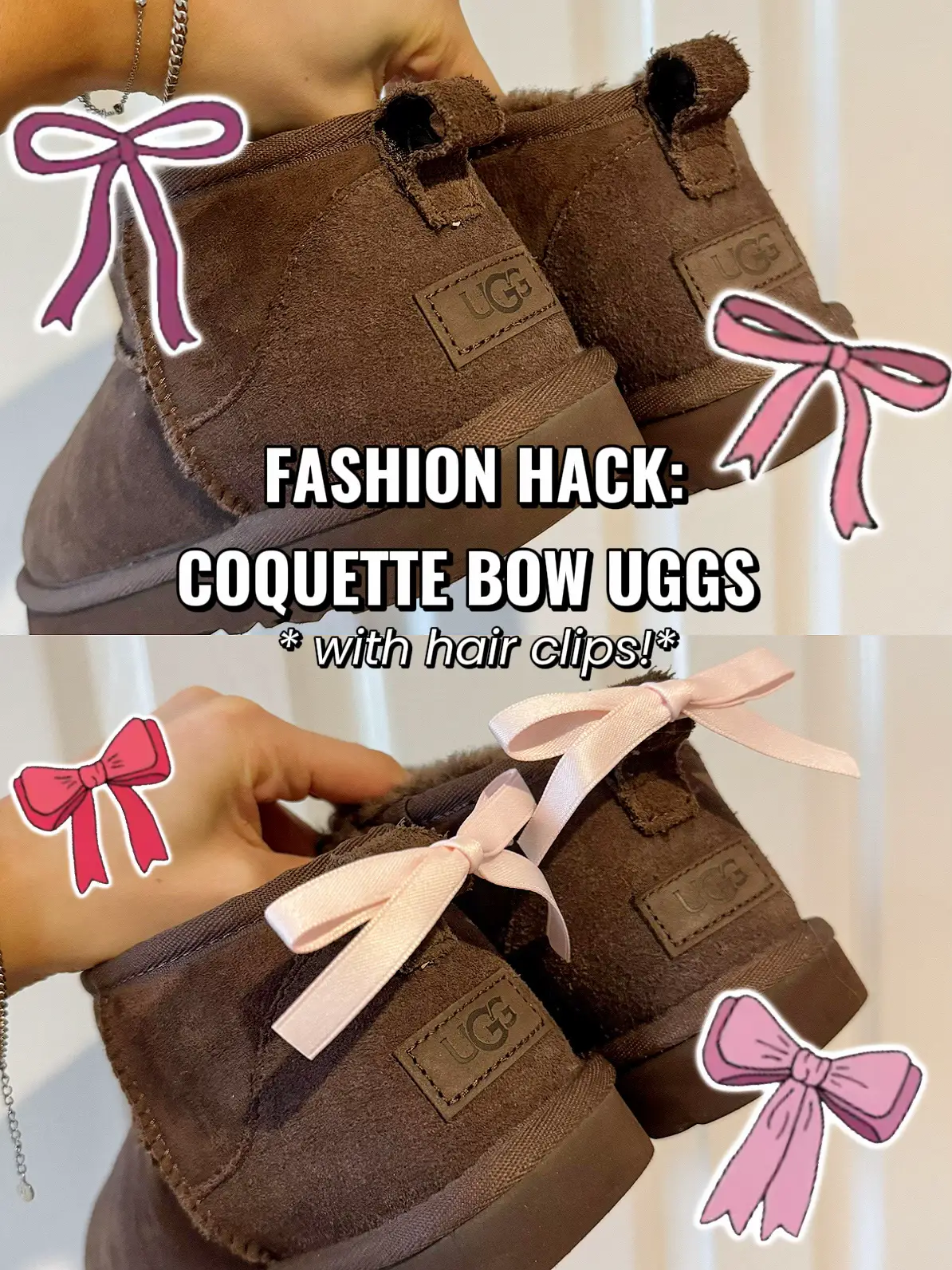 Hack Bow Uggs with Hair Clips Gallery posted by Lexirosenstein