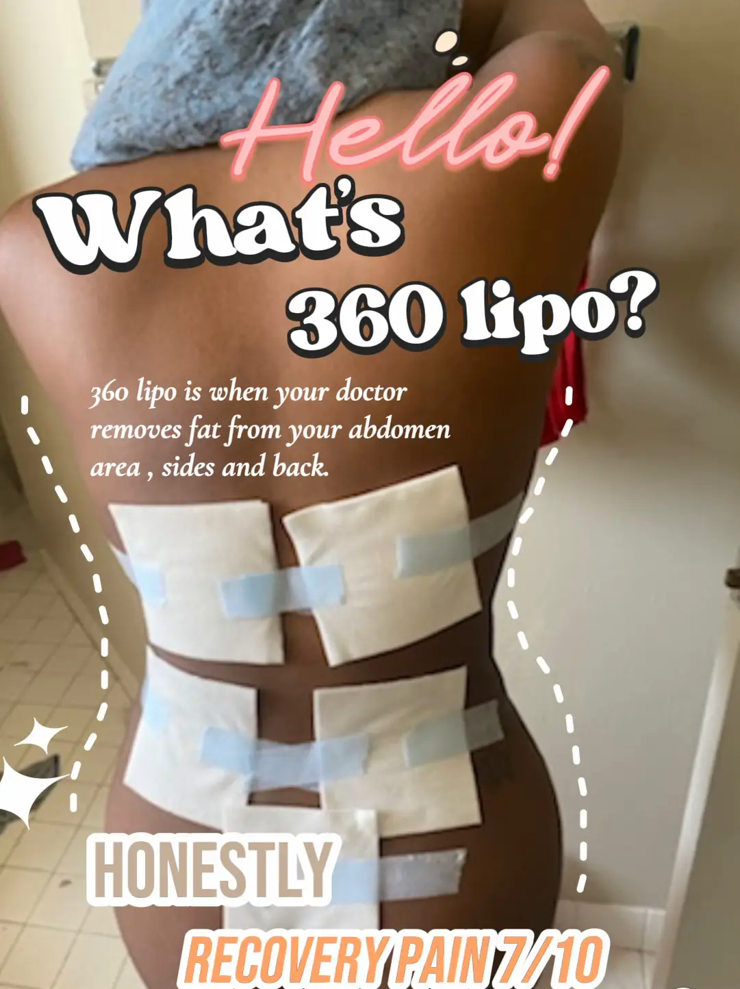 Why Is Post-Operative Care Important for Lipo - Lemon8 Search