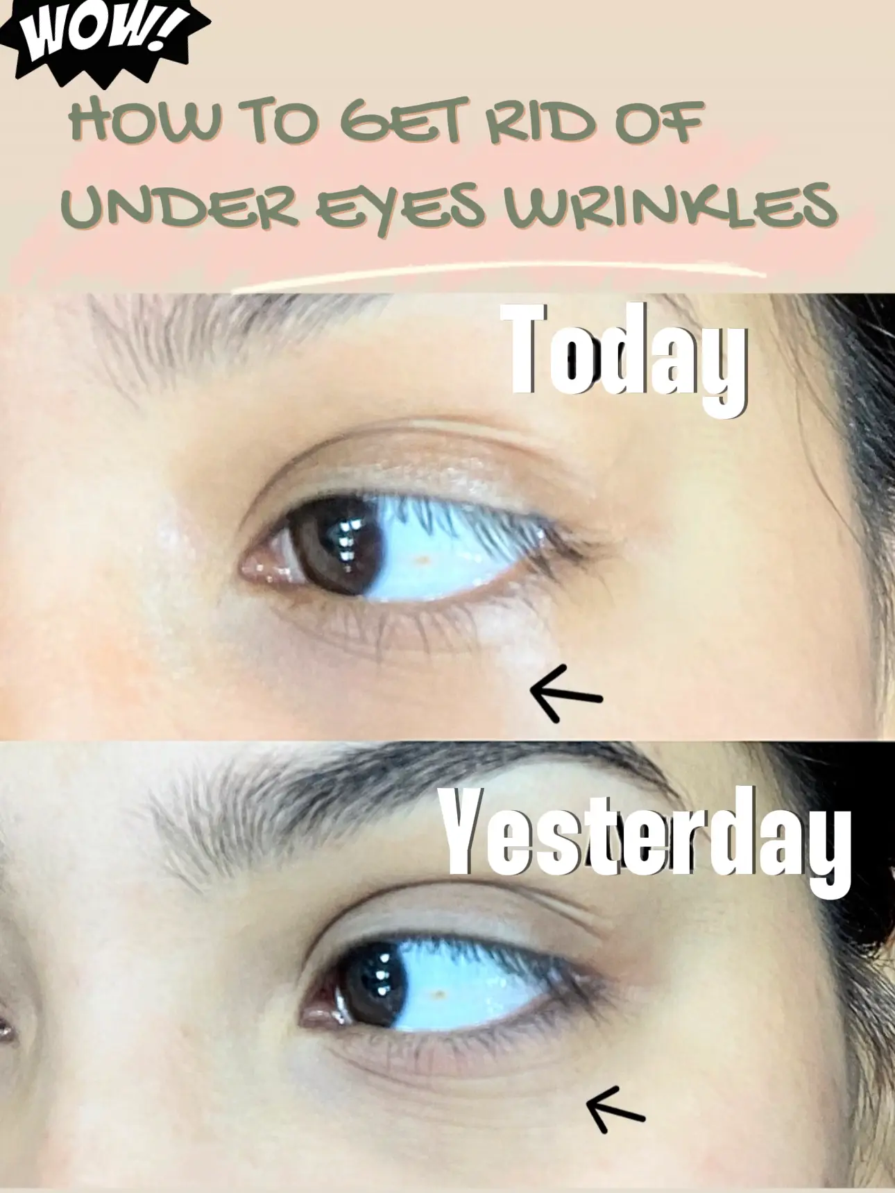 19 top How to Get Rid of Creasing under Eyes ideas in 2024