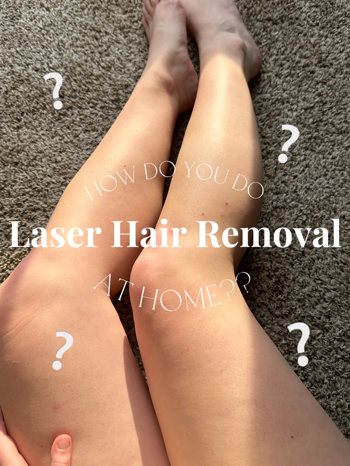 Top hair removal methods