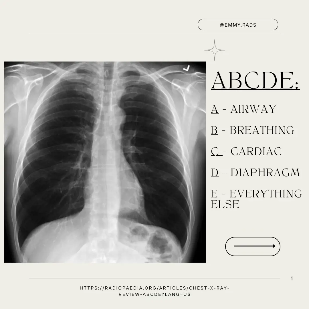 Radiology Student Lemon8 Search