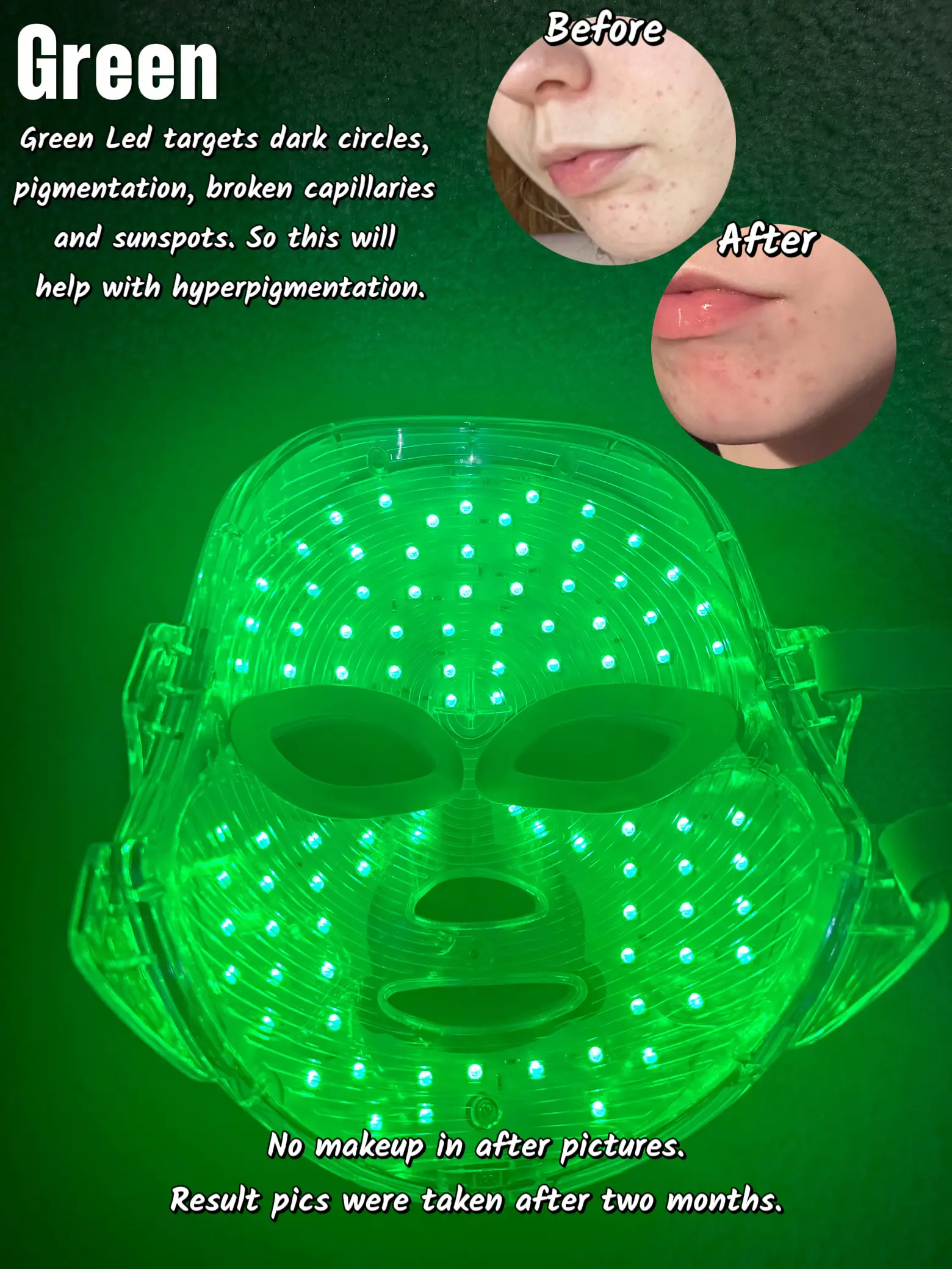 LED MASK RESULTS Gallery posted by Standard Cara Lemon8