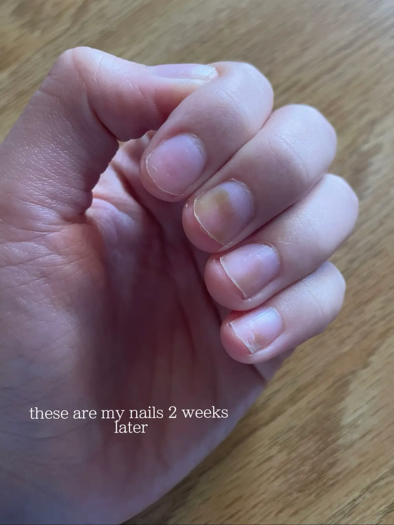 My Nail Turned Green? Gallery posted by MARIA Lemon8