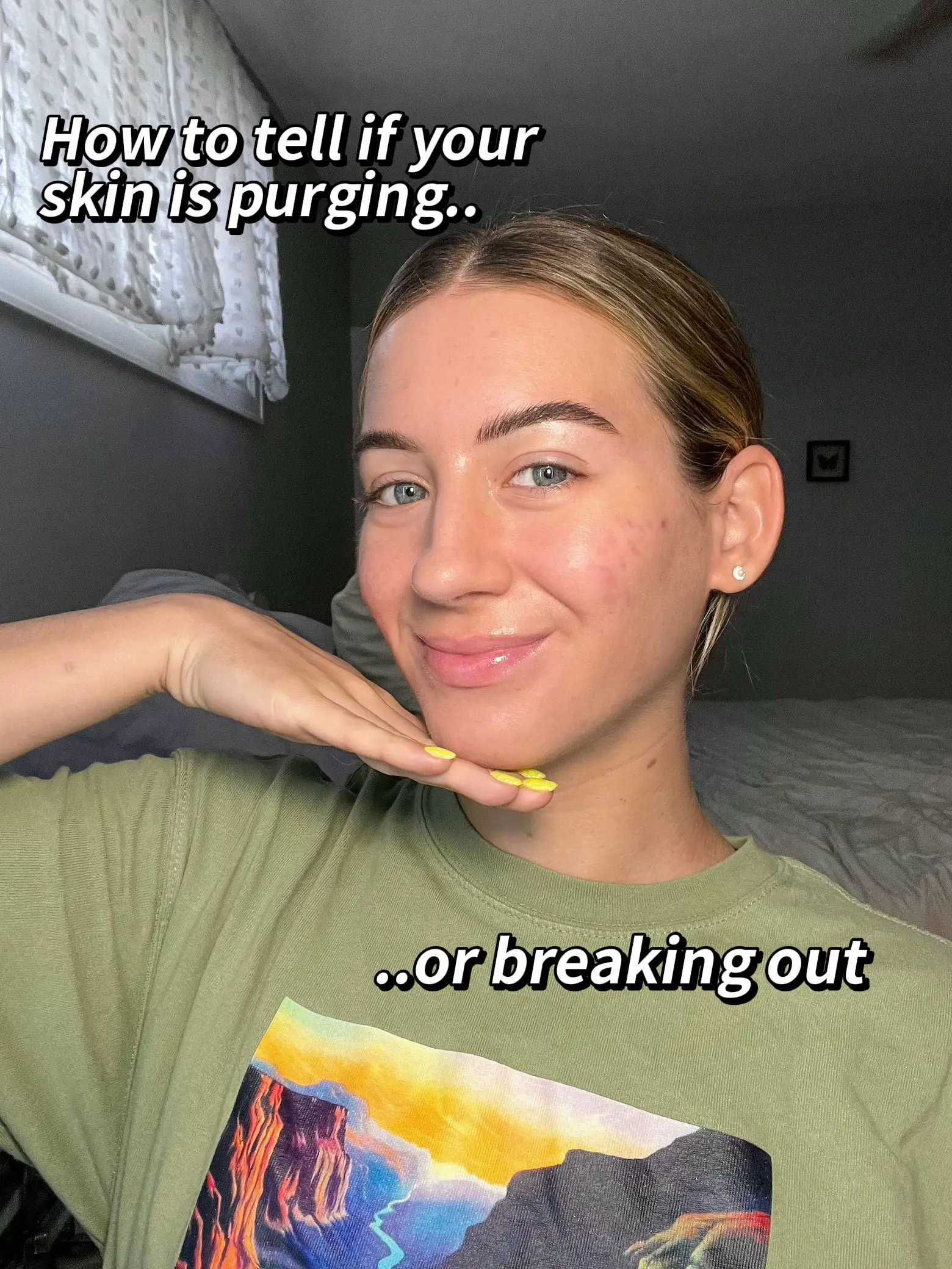 Why Is My Skin Breaking Out - Lemon8 Search