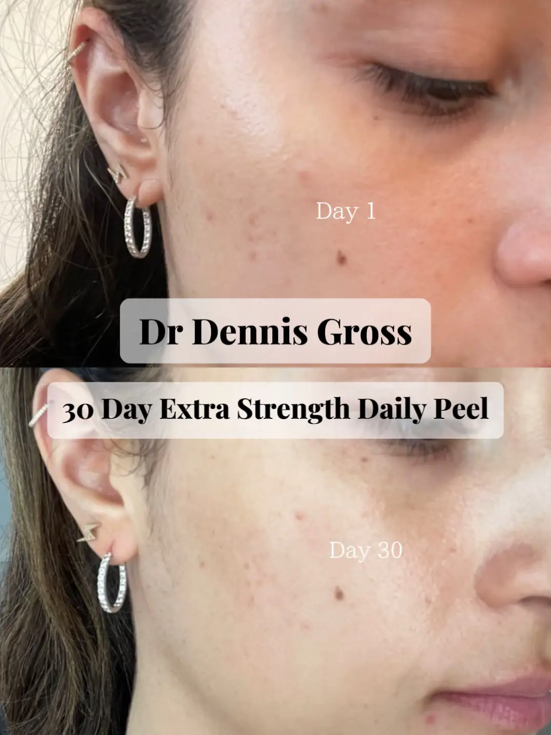 30 Day Extra Strength Daily Peel | Alexis Kathlyn が投稿したフォト