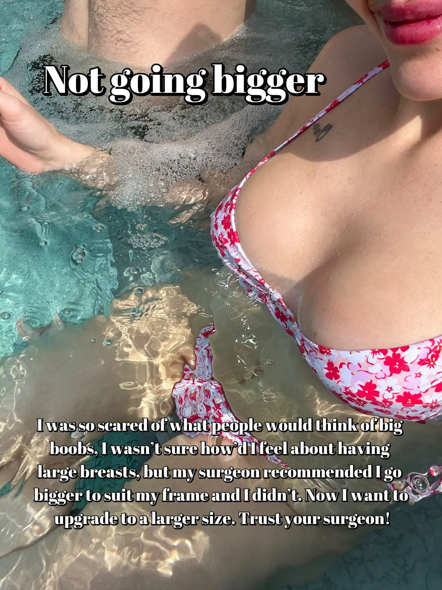 SIS NOE: My friends say my breasts are too big