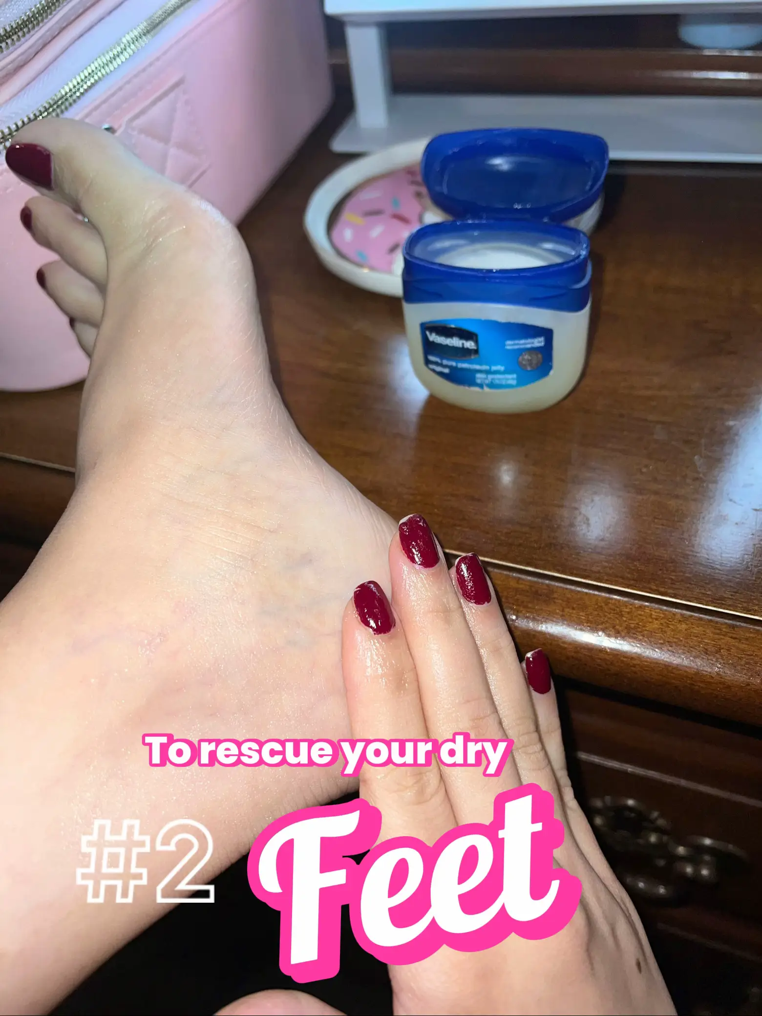 Vaseline between sale toes