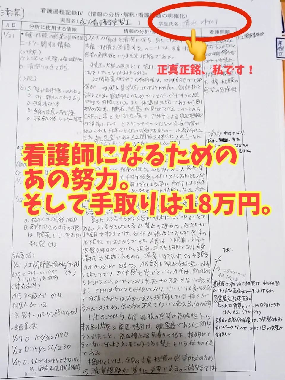 看護実習 看護学生 手順書 アセスメント パンフレット 周手術期 急性期 