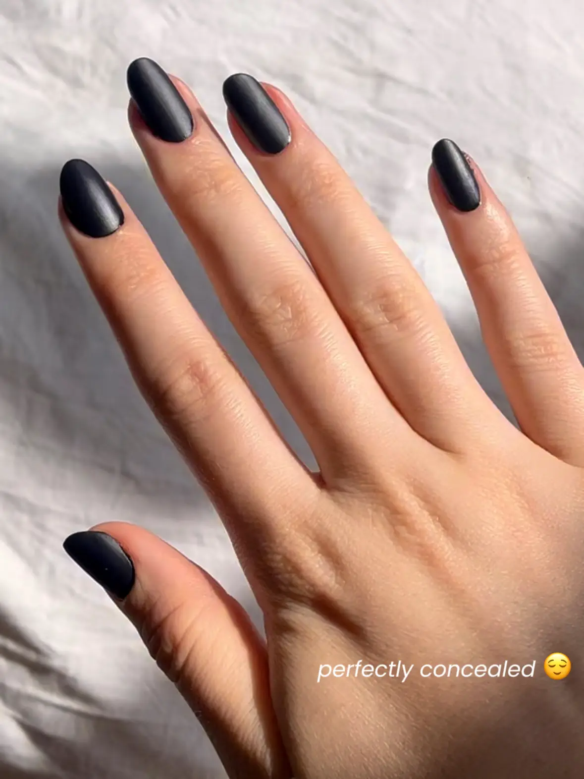 How to Hide a Broken Nail | Gallery posted by glowbysid | Lemon8