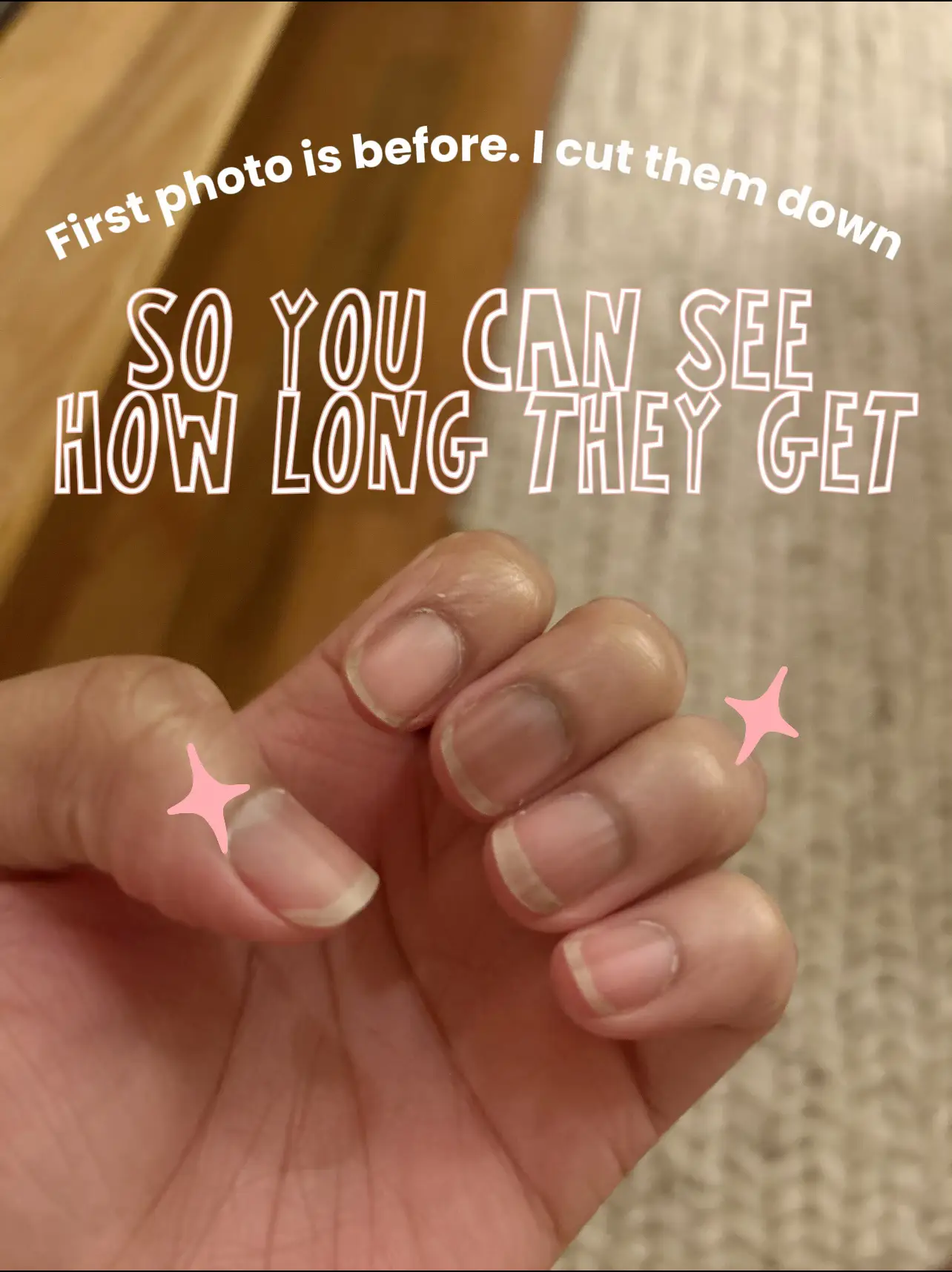 before and after! 😄🌊 its crazy how much my nails are able to grow because  of these wraps, especially with a nail strengther as the base, the wrap and  then a top