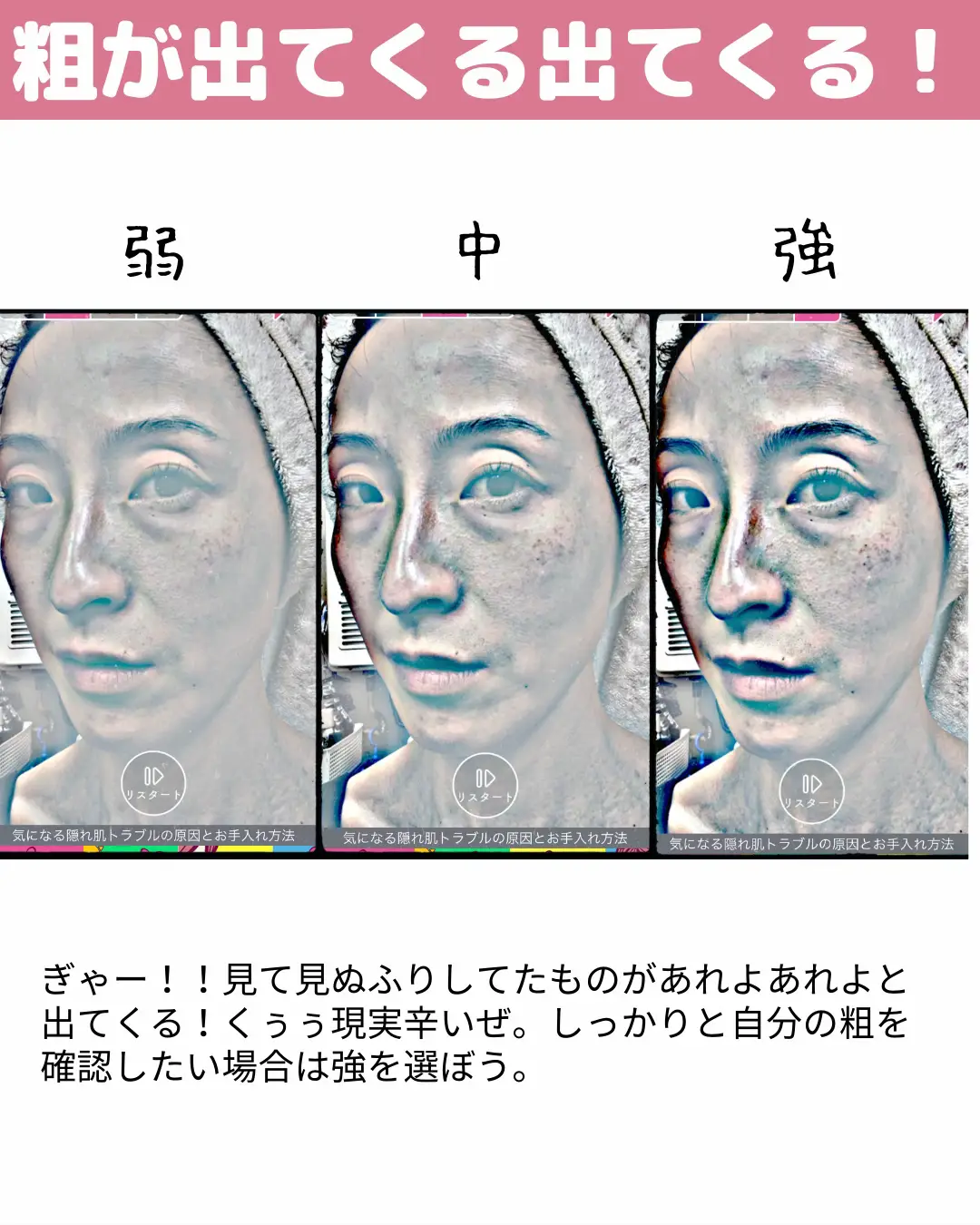 衝撃／自分の肌と向き合う覚悟はできてるか   | kanami_skincareが投稿