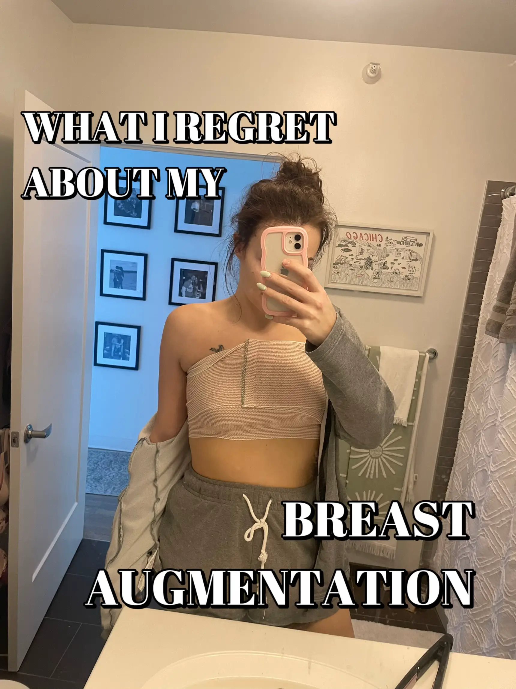 I thought I was dying after my 32G boobs gave me breast implant