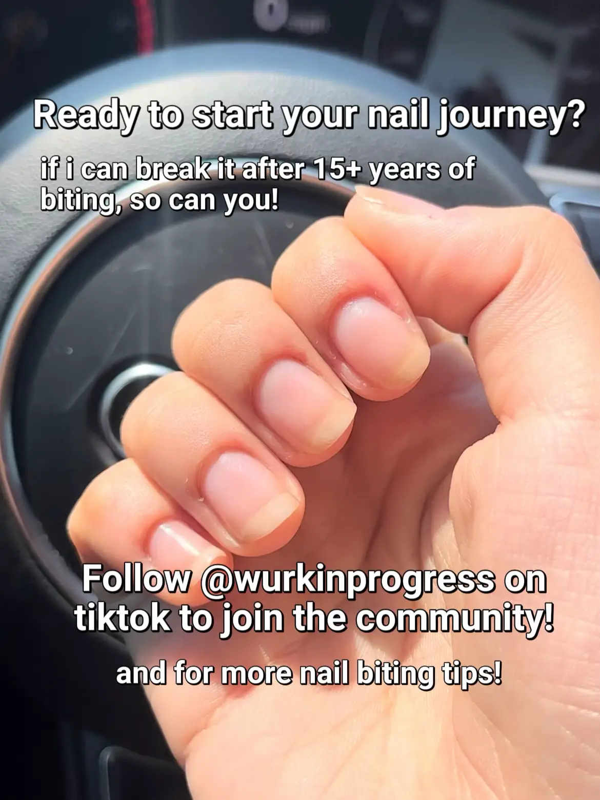 HOW TO STOP BITING YOUR NAILS, Gallery posted by Wurk
