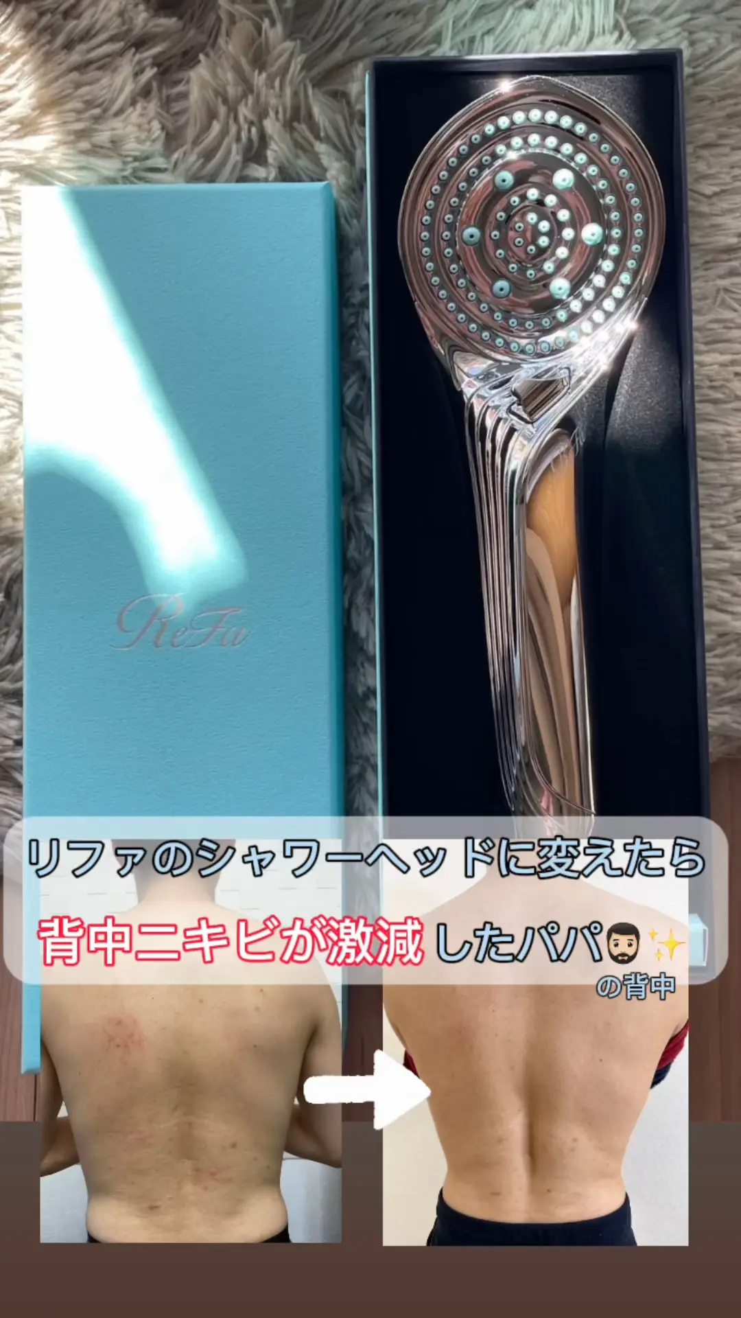 ニキビ シャワーヘッド refa ファインバブル ピュア 本体 ReFa