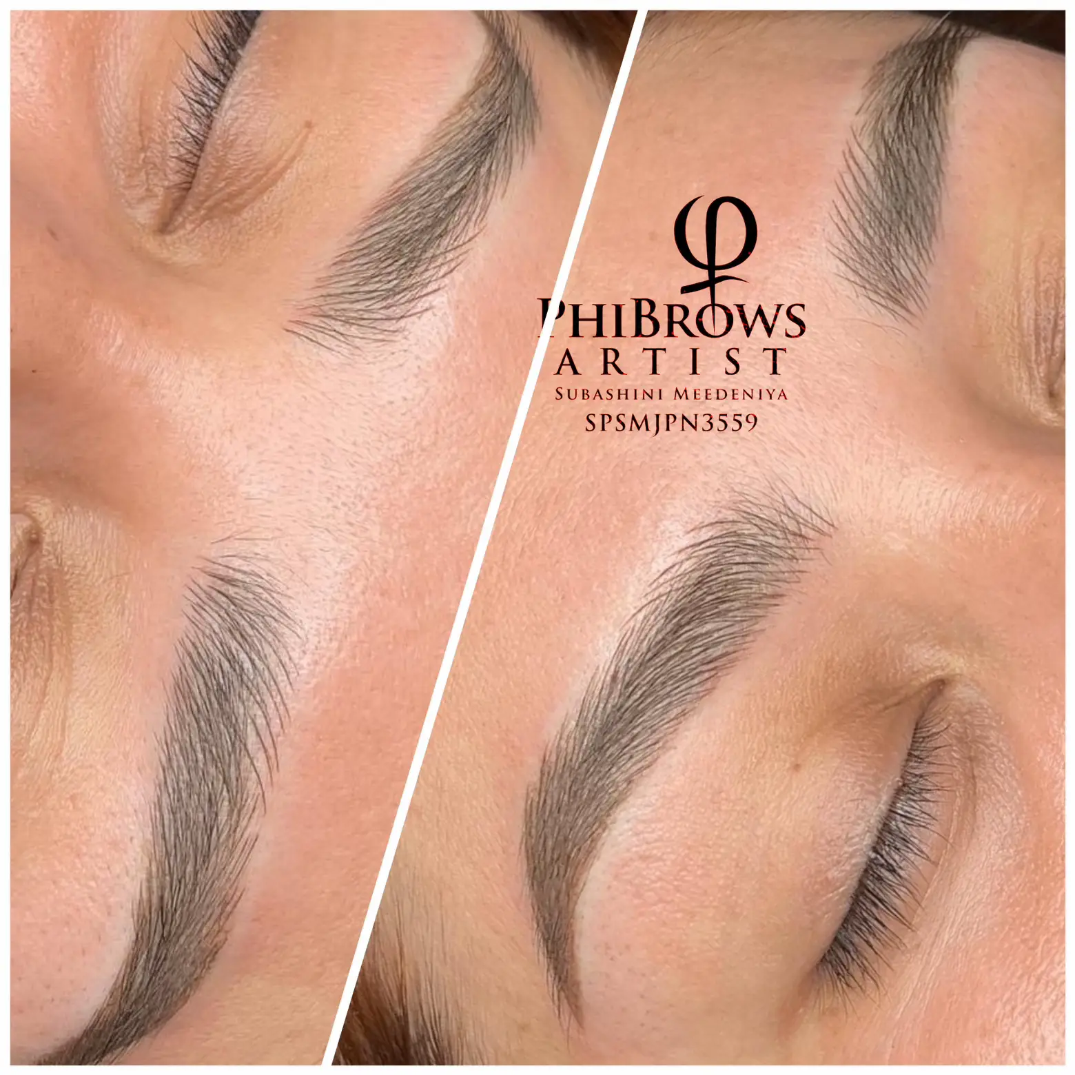 Microblading #美容医療 #美容医療レポ#アートメイク | Medical+が投稿したフォトブック | Lemon8