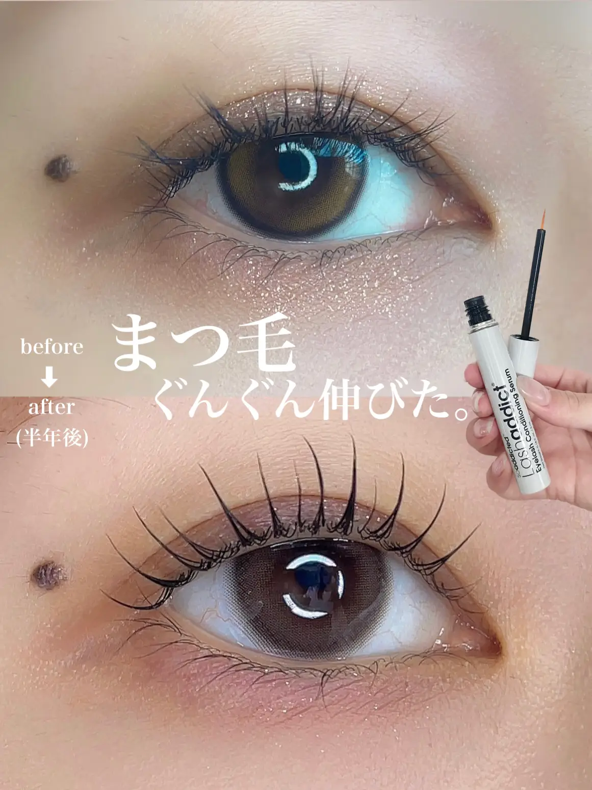 Eyelashes grew steadily.] Lash Addict Review | Gallery posted by