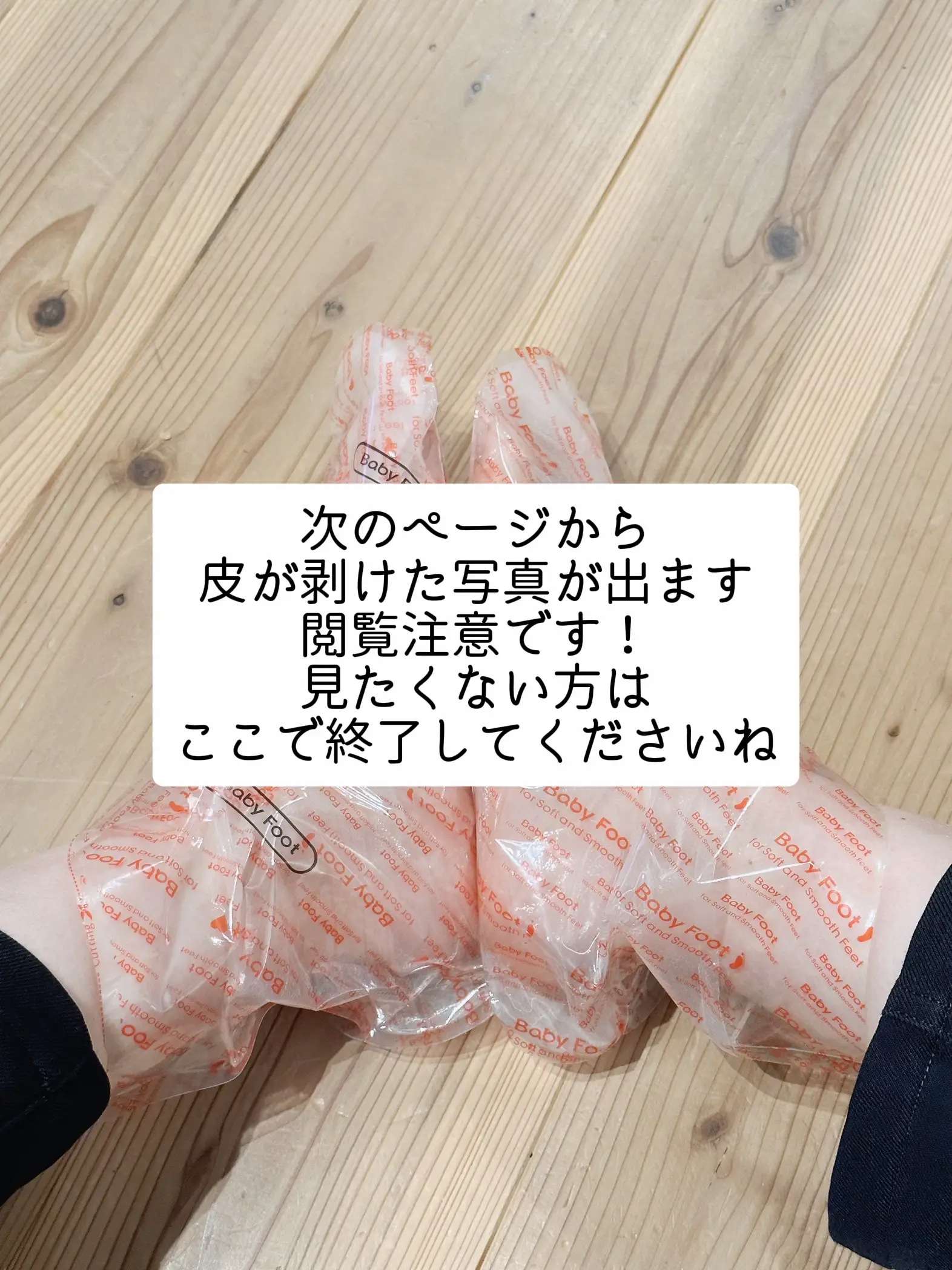 足の皮ズル剥け！生まれ変わった足🦶🥹💖 | あここアラフォー美容/が投稿したフォトブック | Lemon8