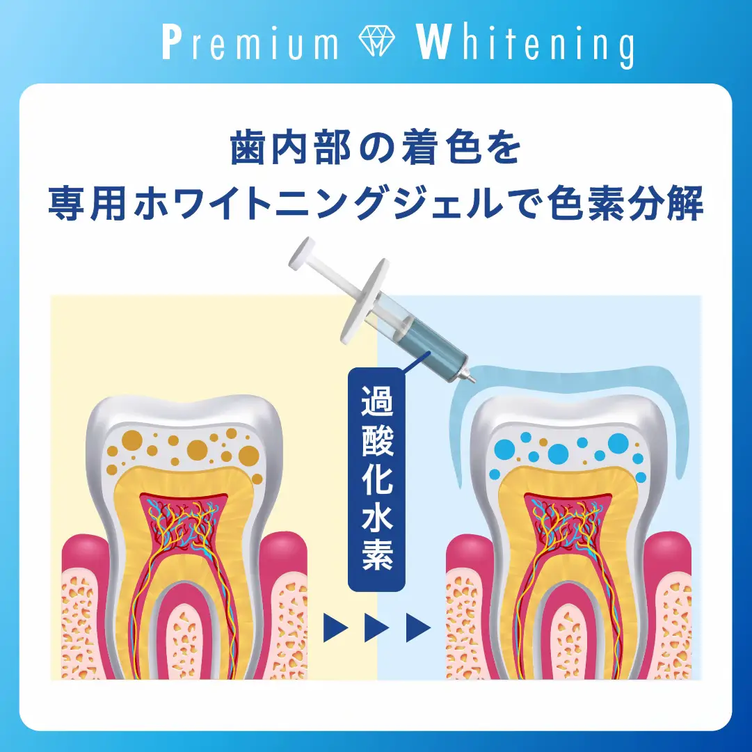 通常納期 プレミアムホワイトニングジェル premium whitening gel