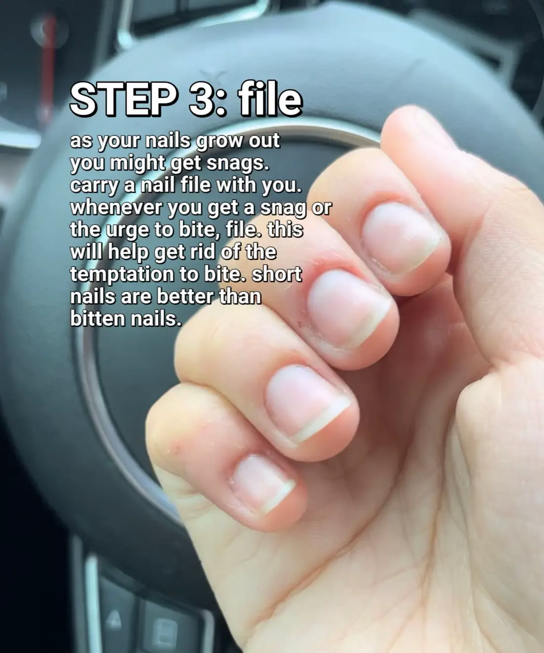 HOW TO STOP BITING YOUR NAILS, Gallery posted by Wurk