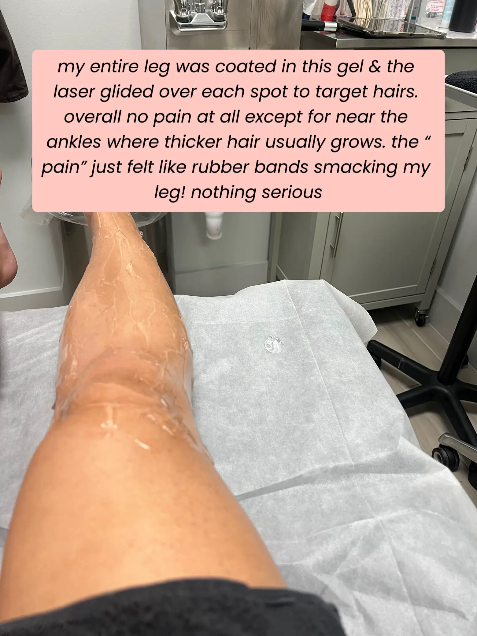 MY LASER HAIR REMOVAL EXPERIENCE Gallery posted by