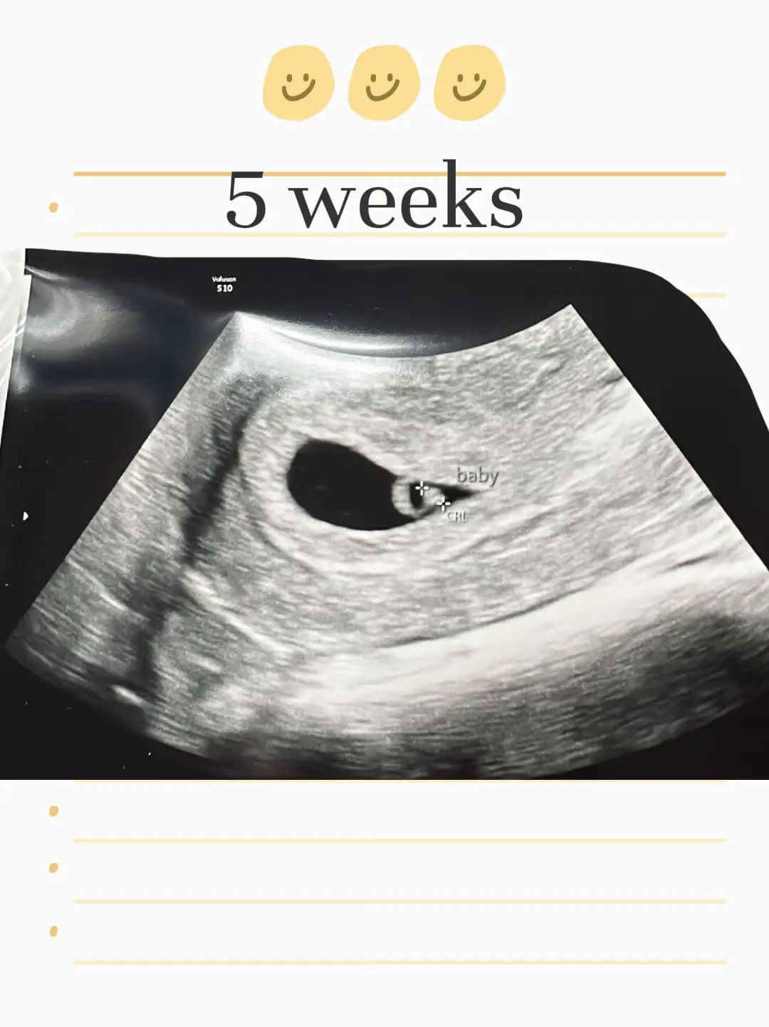7w5d Brown Discharge? Tmi pic - May 2019 Babies, Forums