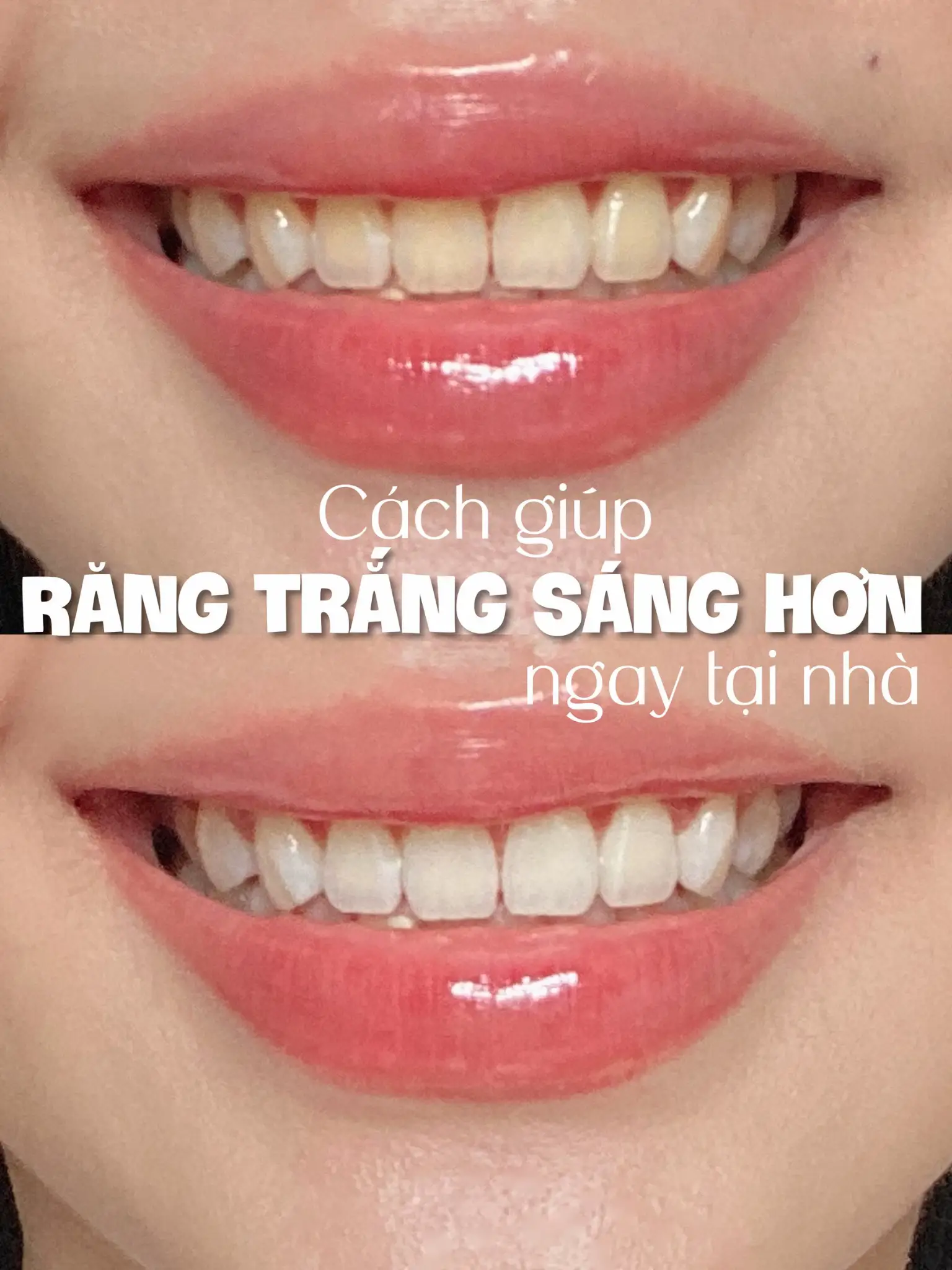  A person's teeth are shown with the words "Cách hùn RĂNG TRẮNG SÁNG HƠN" written above them.